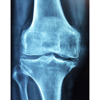 Infusion Rhumatismes - Ostéomagique