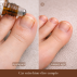 MYCOSE - Mélange d'huiles essentielles - Roll-on - 10ml 